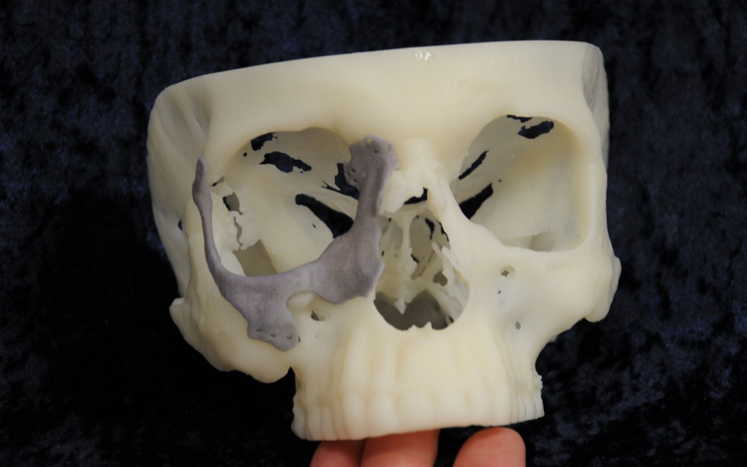 Medical applications lead 3D printing advances